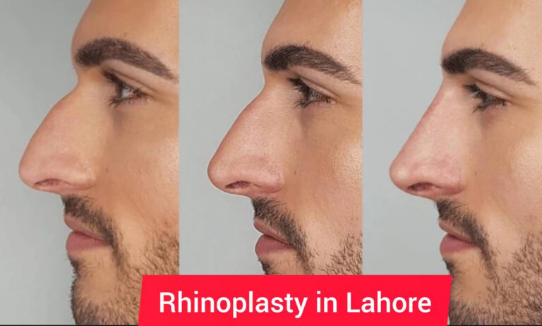 Unveiling the Art of Rhinoplasty: Transforming Lives in Lahore’s Leading Clinic